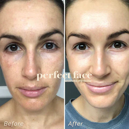 Celimax The Vita-A Retinal Shot Tightening Booster